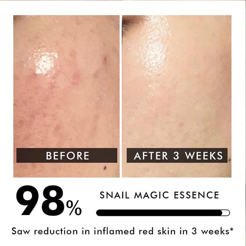 Advanced Snail Mucin Power Essence - Image 4